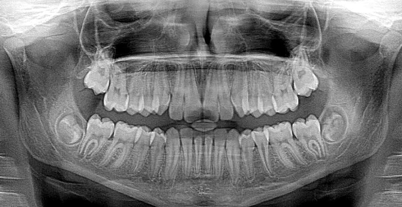 Smile Dental Studio